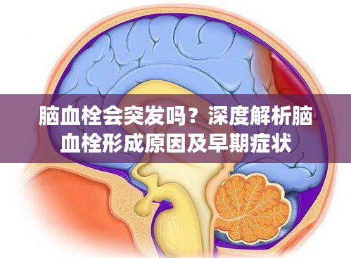 脑血栓会突发吗?深度解析脑血栓形成原因及早期症状